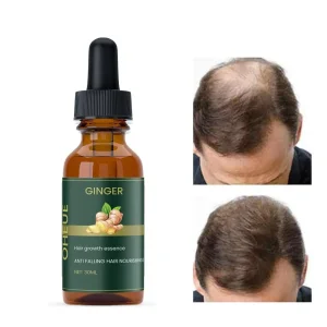 Ginger Hair Growth Essence 60ml Pack Of 2
